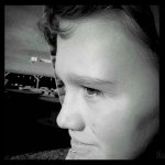 Complicated Migraine-that’s all it was?